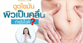 ดูดไขมันผิวเป็นคลื่น ไม่เรียบ