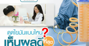 ดูดไขมันแบบไหนเหมาะกับเรา