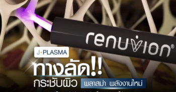 เจพลาสมา