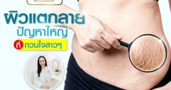 รอยแตกลาย