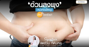 อ้วนลงพุง