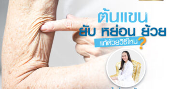 ต้นแขนย้วย หย่อน ยาน