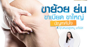 ขาใหญ่ ขาเบียด