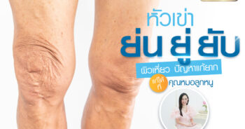 เข่าย่น เข่ายู่