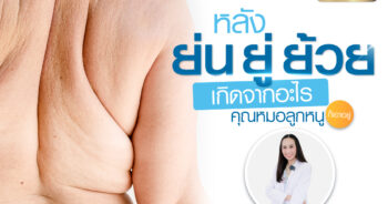 หลังย้วย ย่น ยู้