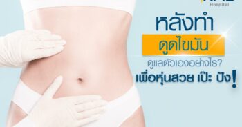 หลังดูดไขมัน-หมอลูกหนู